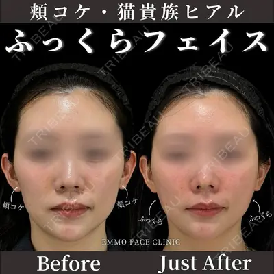 EMMO FACE CLINIC 東京三田院 木之下 哲彦医師の症例