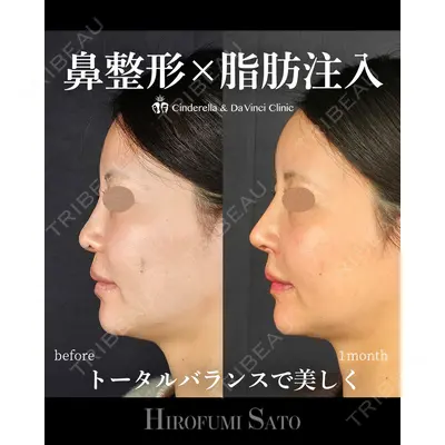 シンデレラ＆ダヴィンチクリニック 佐藤 博文医師の症例