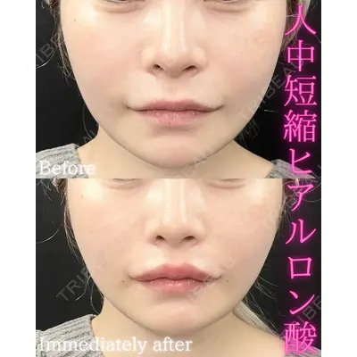 THE FIRST CLINIC 町田院の症例