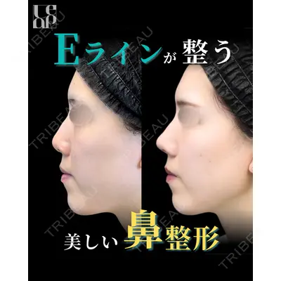 Leap beauty clinic 土門 駿也医師の症例