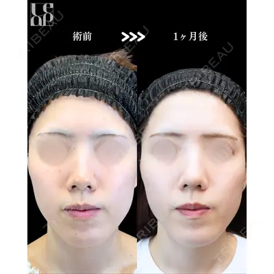 Leap beauty clinic 土門 駿也医師の症例