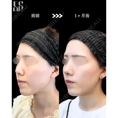 Leap beauty clinic 土門 駿也医師の症例