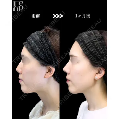 Leap beauty clinic 土門 駿也医師の症例