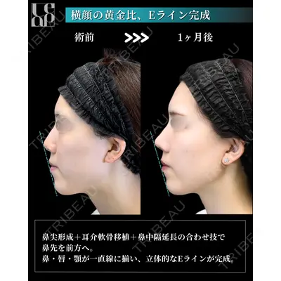 Leap beauty clinic 土門 駿也医師の症例