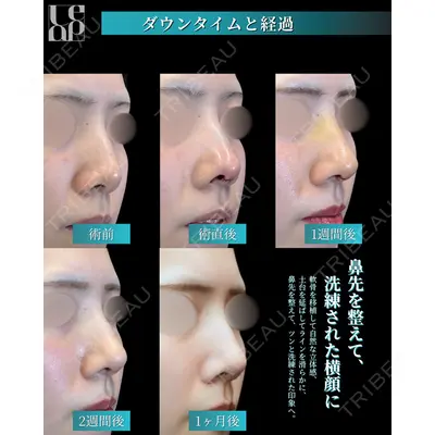Leap beauty clinic 土門 駿也医師の症例