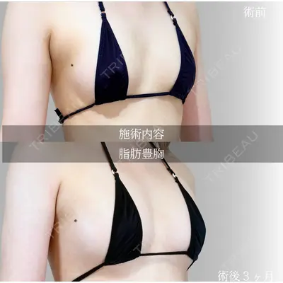アリエル美容クリニック 横浜院 加藤 敏次医師の症例