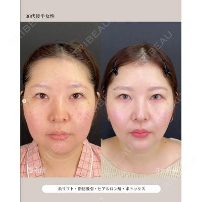 自由が丘ウェルエイジングビューティークリニックの症例