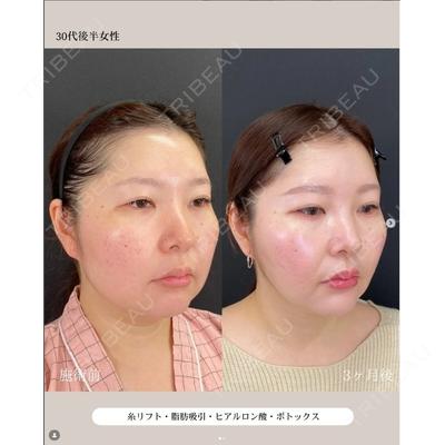 自由が丘ウェルエイジングビューティークリニック 福田 知佐子医師の症例