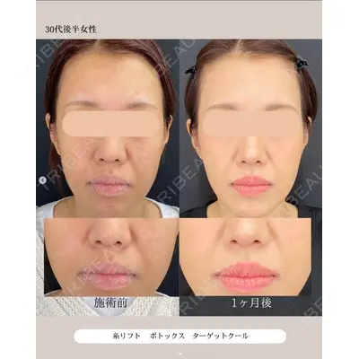 自由が丘ウェルエイジングビューティークリニック 福田 知佐子医師の症例