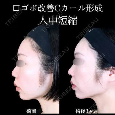 アリエル美容クリニック 大宮院 阪野 一世医師の症例