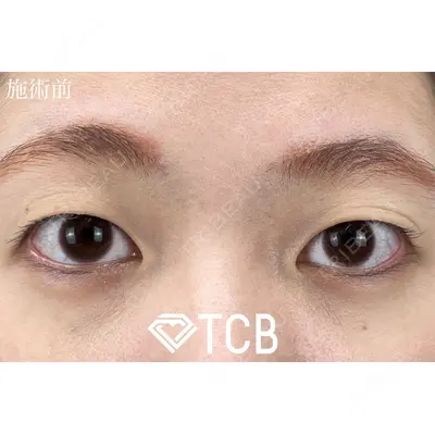 TCB東京中央美容外科 大宮東口院の症例