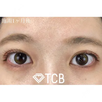 TCB東京中央美容外科 大宮東口院の症例