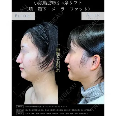 eクリニック 新宿院 相原 隆充医師の症例