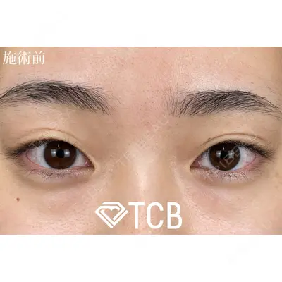 TCB東京中央美容外科 大宮東口院の症例