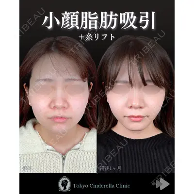東京シンデレラ美容外科 池袋院 石井 達也医師の症例