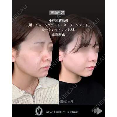 東京シンデレラ美容外科 池袋院 石井 達也医師の症例