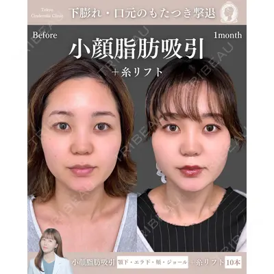 東京シンデレラ美容外科 新宿院 宮﨑友伽医師の症例