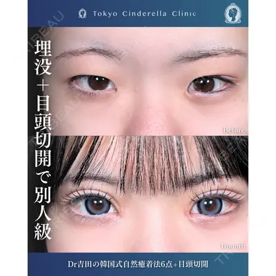 東京シンデレラ美容外科  横浜院 吉田 利之医師の症例