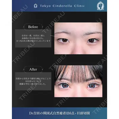 東京シンデレラ美容外科  横浜院 吉田 利之医師の症例