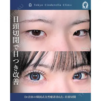 東京シンデレラ美容外科  横浜院 吉田 利之医師の症例