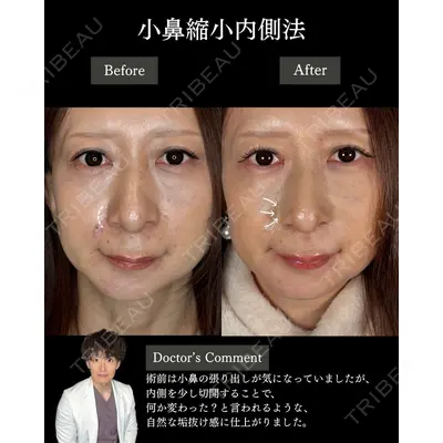 札幌美容外科ネビュラクリニック 横田 開医師の症例