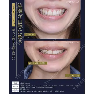 聖心美容クリニック 広島院 中辻 隆徳医師の症例