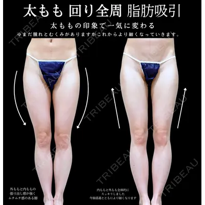 アリエル美容クリニック 横浜院 加藤 敏次医師の症例