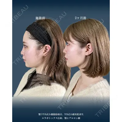 TCB東京中央美容外科 前橋院の症例