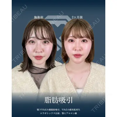 TCB東京中央美容外科 前橋院の症例