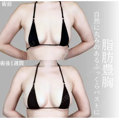 アリエル美容クリニック 横浜院 加藤 敏次医師の症例