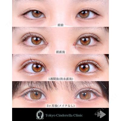 東京シンデレラ美容外科 池袋院 石井 達也医師の症例