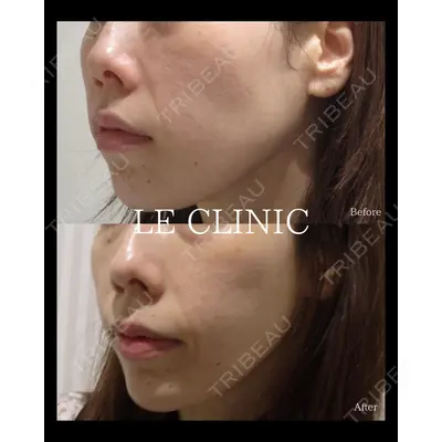 LE CLINICの症例