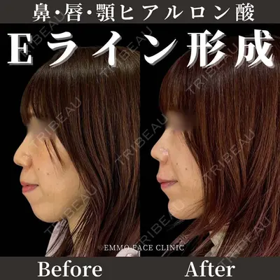 EMMO FACE CLINIC 東京三田院 木之下 哲彦医師の症例