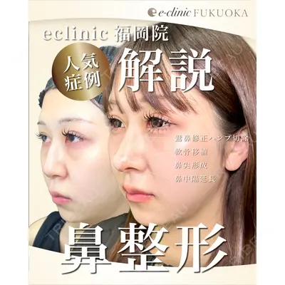 eクリニック 福岡院 伊藤 渉医師の症例
