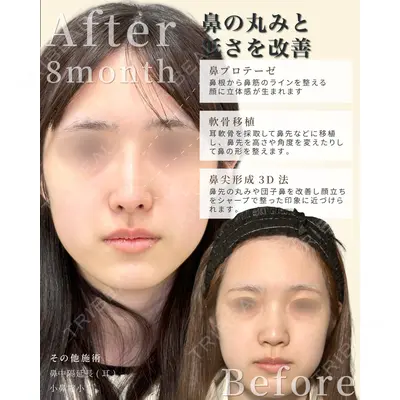 eクリニック 福岡院 伊藤 渉医師の症例