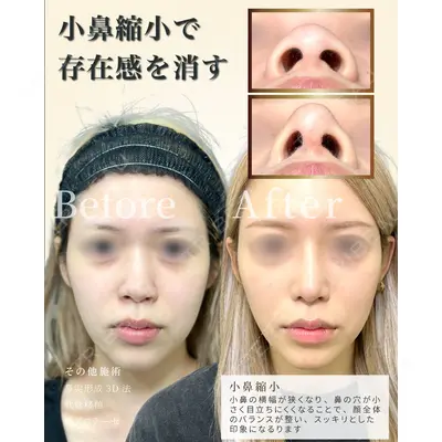 eクリニック 福岡院 伊藤 渉医師の症例