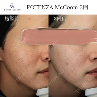 LOUIS CLINIC 二子玉川院【ルイクリニック】 小松 塁医師の症例