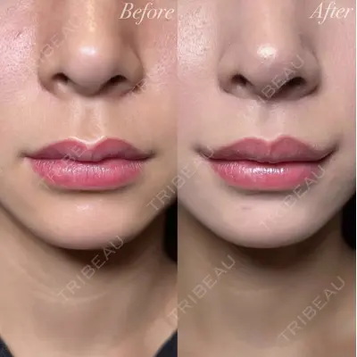 R Beauty CLINIC 大阪院 小池 泰弘医師の症例