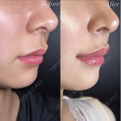 R Beauty CLINIC 大阪院 小池 泰弘医師の症例