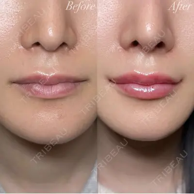 R Beauty CLINIC 大阪院 小池 泰弘医師の症例