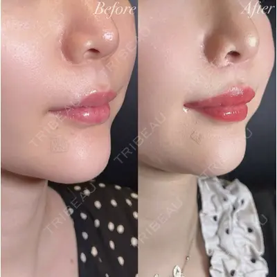R Beauty CLINIC 大阪院 小池 泰弘医師の症例