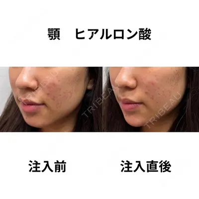 おおたかの森ビューティークリニックの症例