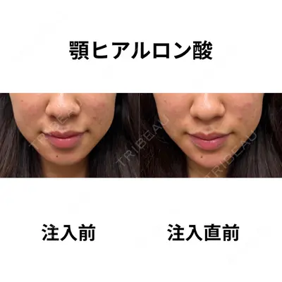 おおたかの森ビューティークリニックの症例