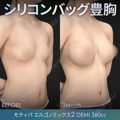 ジョウクリニック 銀座院 重本　譲医師の症例