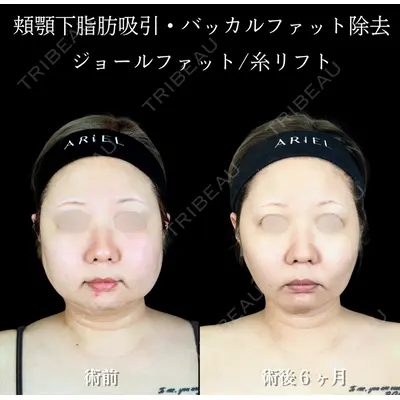 アリエル美容クリニック 横浜院 渡邉 光医師の症例