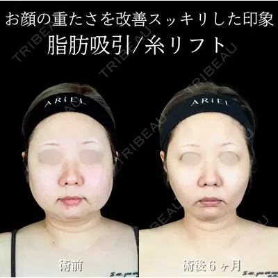 アリエル美容クリニック 横浜院 渡邉 光医師の症例
