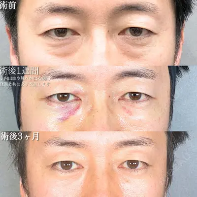 アリエル美容クリニック 大宮院 鈴木　桂介医師の症例