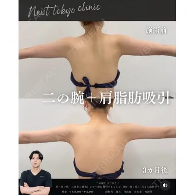 Next Tokyo Clinic 松本 俊太郎医師の症例
