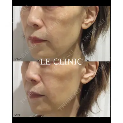 LE CLINICの症例