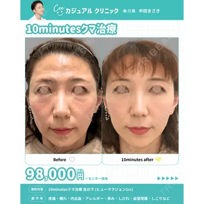 カジュアルクリニック 平塚院 中田 征希医師の症例